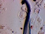 Diatom, Cyclotella